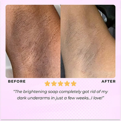 Glowmelanin™ Turmeric Soap