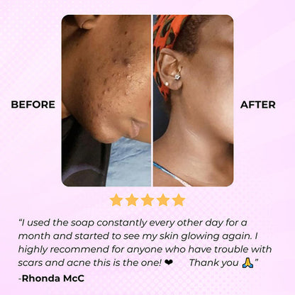 Glowmelanin™ Turmeric Soap